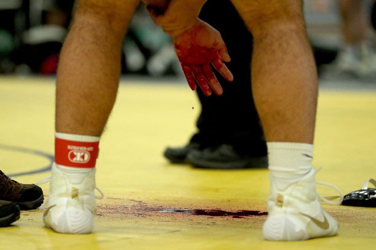 Wantagh's Nick Aldino bleeds during a match against Brentwood's Elmer Cruz during their 285 pound bout at the 2022 NYSPHSAA Wrestling Dual Meet Championships at SRC Arena in Syracuse, N.Y. on Jan. 29, 2022.